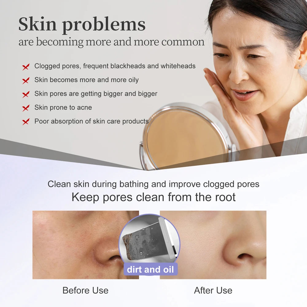 Ultrasonic Facial Skin Scrubber – Deep Cleansing EMS Anti-Aging Device