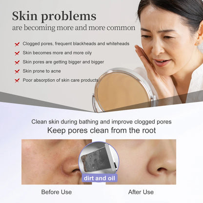 Ultrasonic Facial Skin Scrubber – Deep Cleansing EMS Anti-Aging Device
